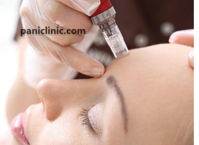 میکرونیدلینگ | کلینیک پانی