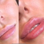 lip filer pani